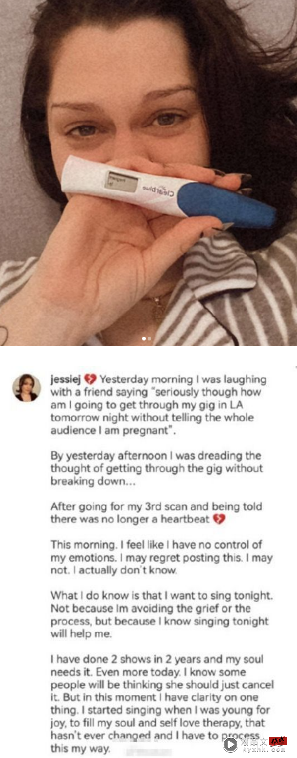 《歌手2018》Jessie J流产！还没来得及公开喜讯...发现宝宝没了心跳 娱乐资讯 图1张